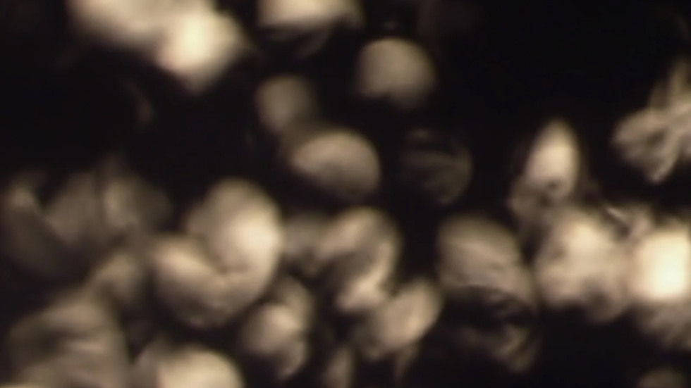 A blurry, black and white photograph captures a cluster of rounded, kidney-shaped objects resembling cells, out of focus and set against a dark background.